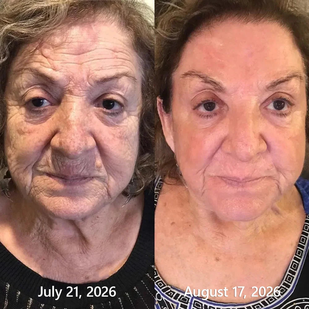 PDRN Anti-Aging and Spot Care
