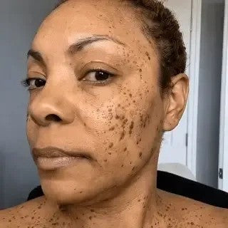 Visible uneven-looking skin concerns