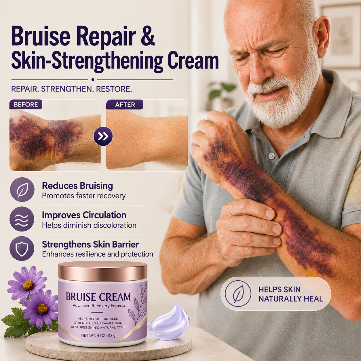 Older adult with visible bruising on the forearm
