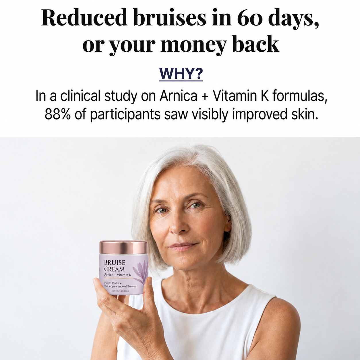 Mature woman holding Bruise Cream