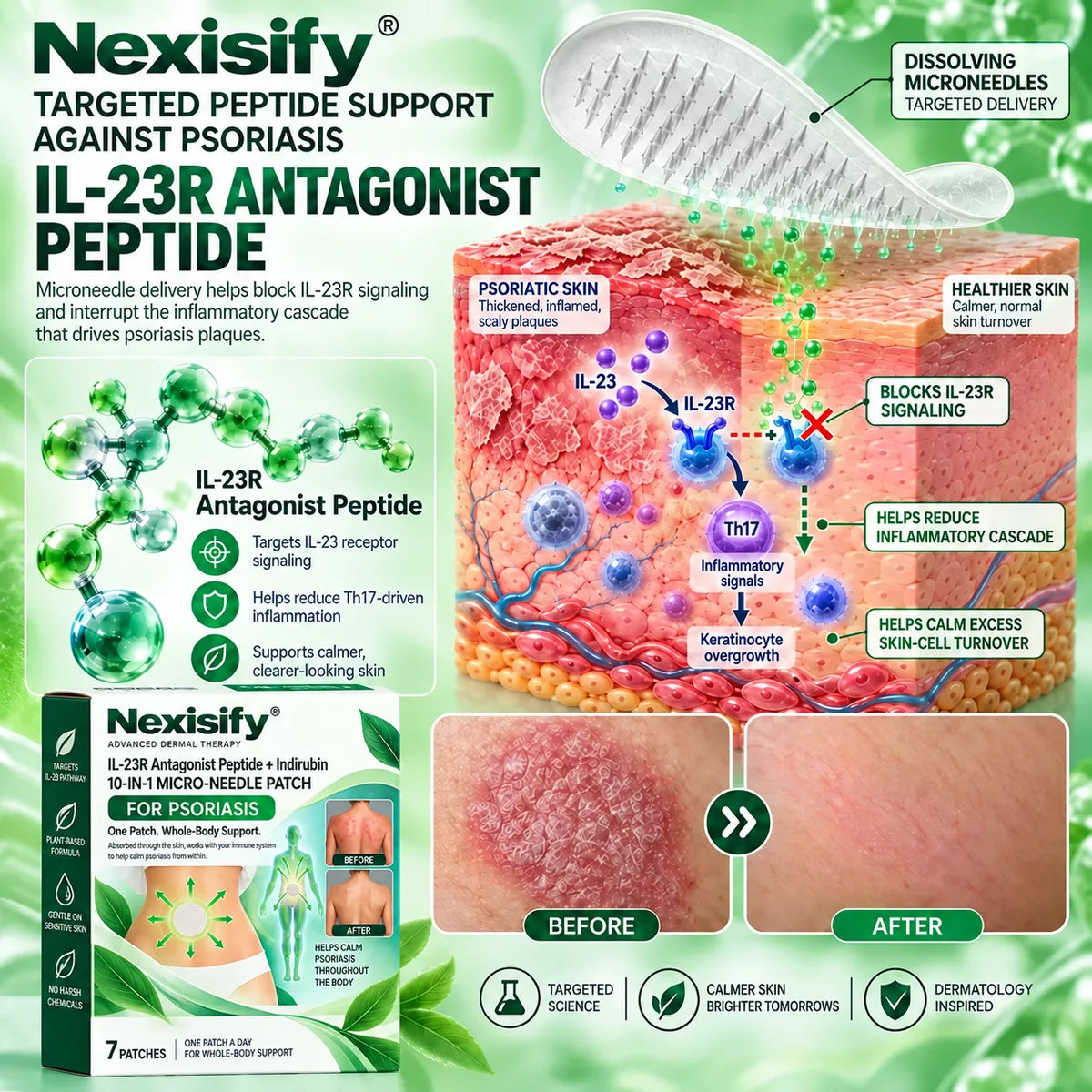 Nexisify infographic illustrating IL-23R antagonist peptide, microneedle delivery and psoriasis-prone skin