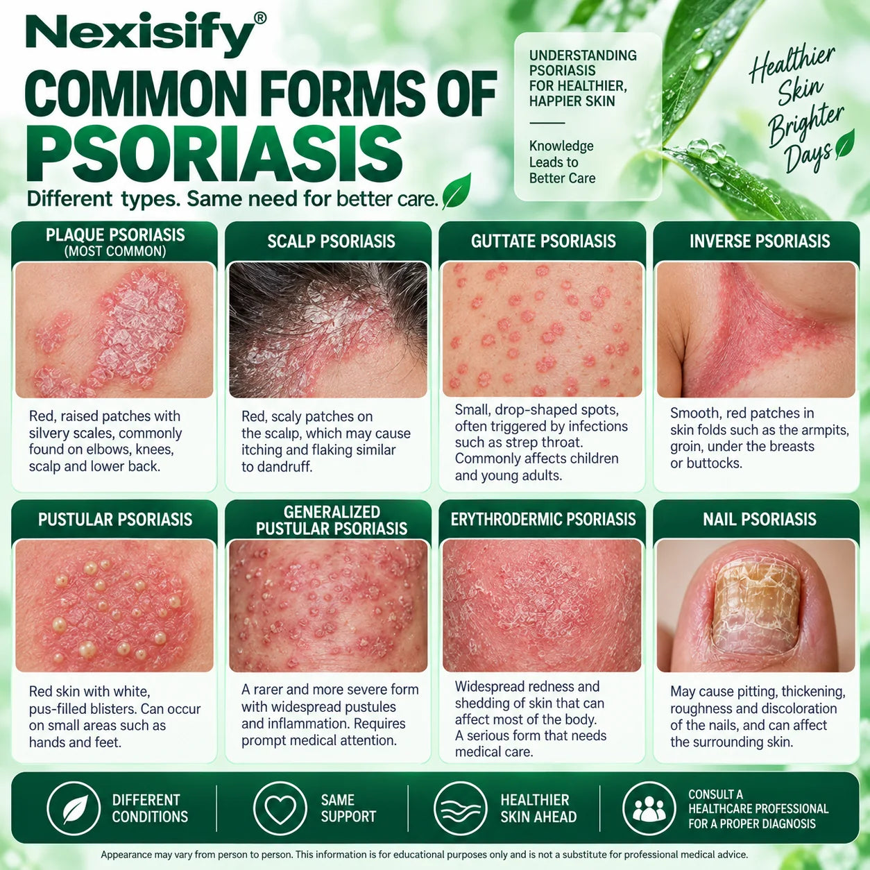 Educational infographic showing common forms of psoriasis including plaque, scalp, guttate, inverse, pustular and nail psoriasis